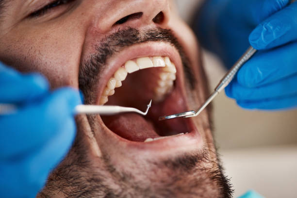 Best Emergency Root Canal Treatment in Mackinac Island, MI